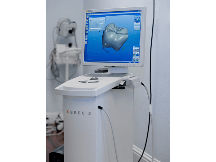 CEREC Technology